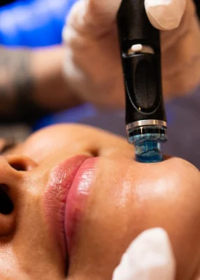 hydrafacial bilbao